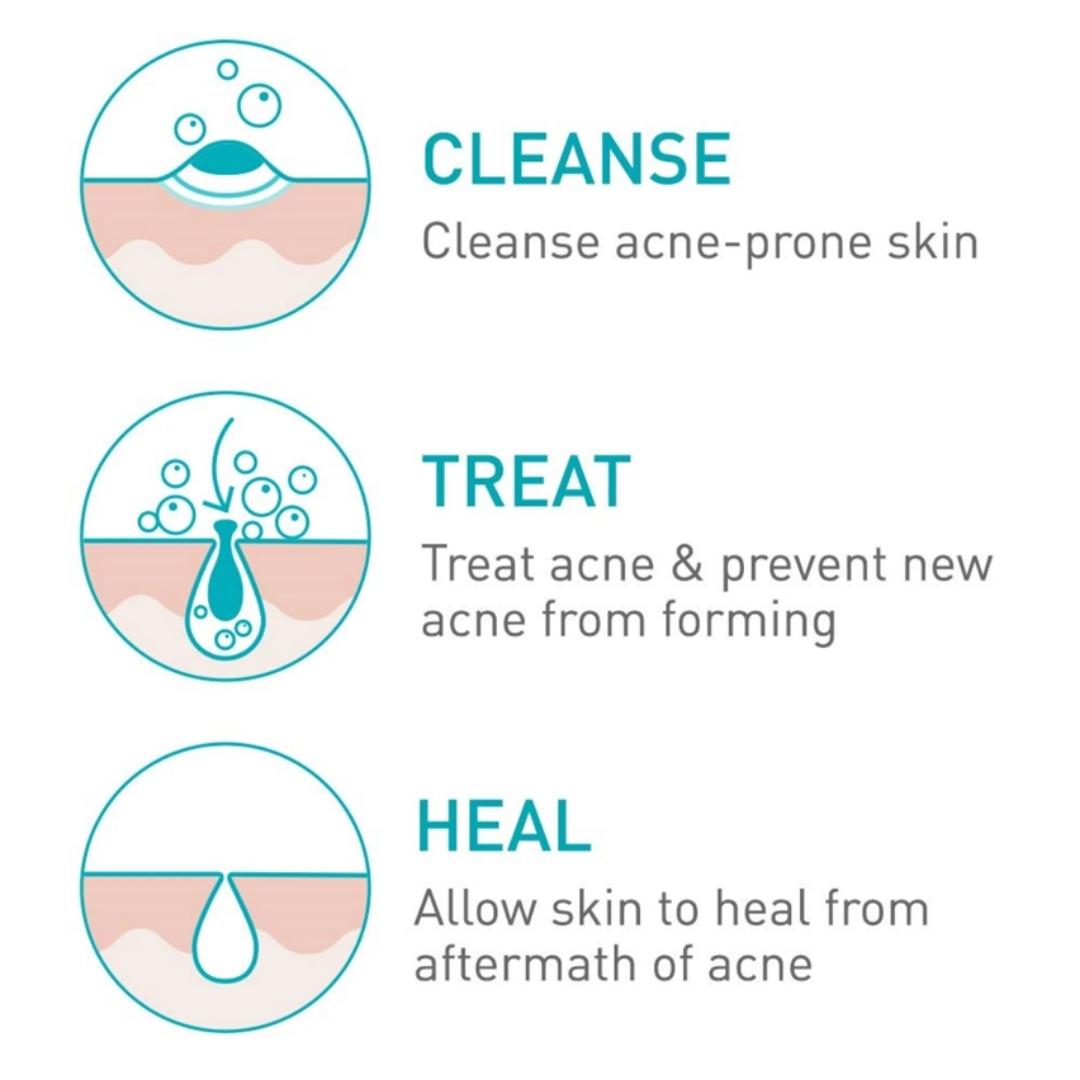 CeraVe Acne Foaming Cream Cleanser 150 ml